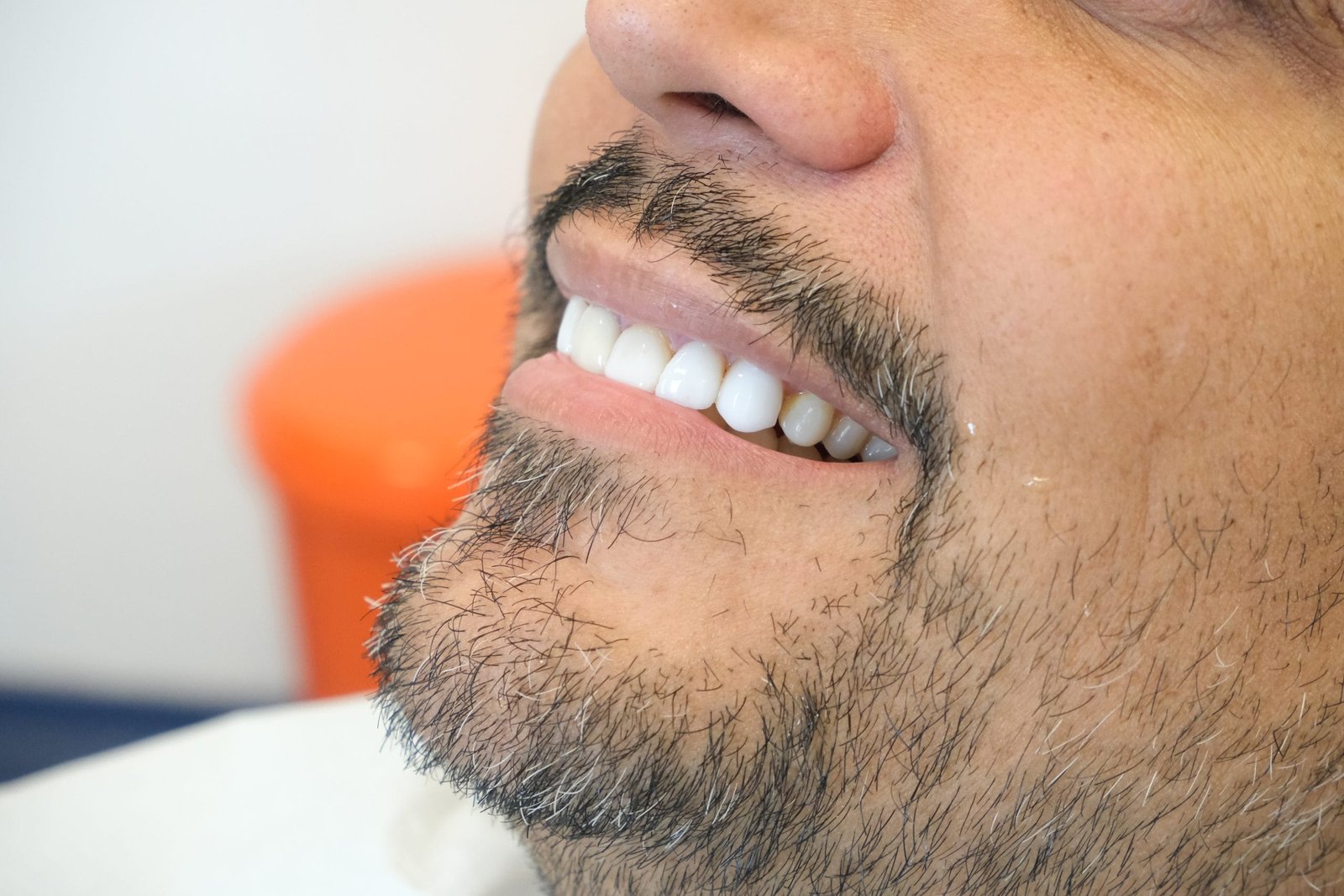 Hollywood Smile Sonuçları